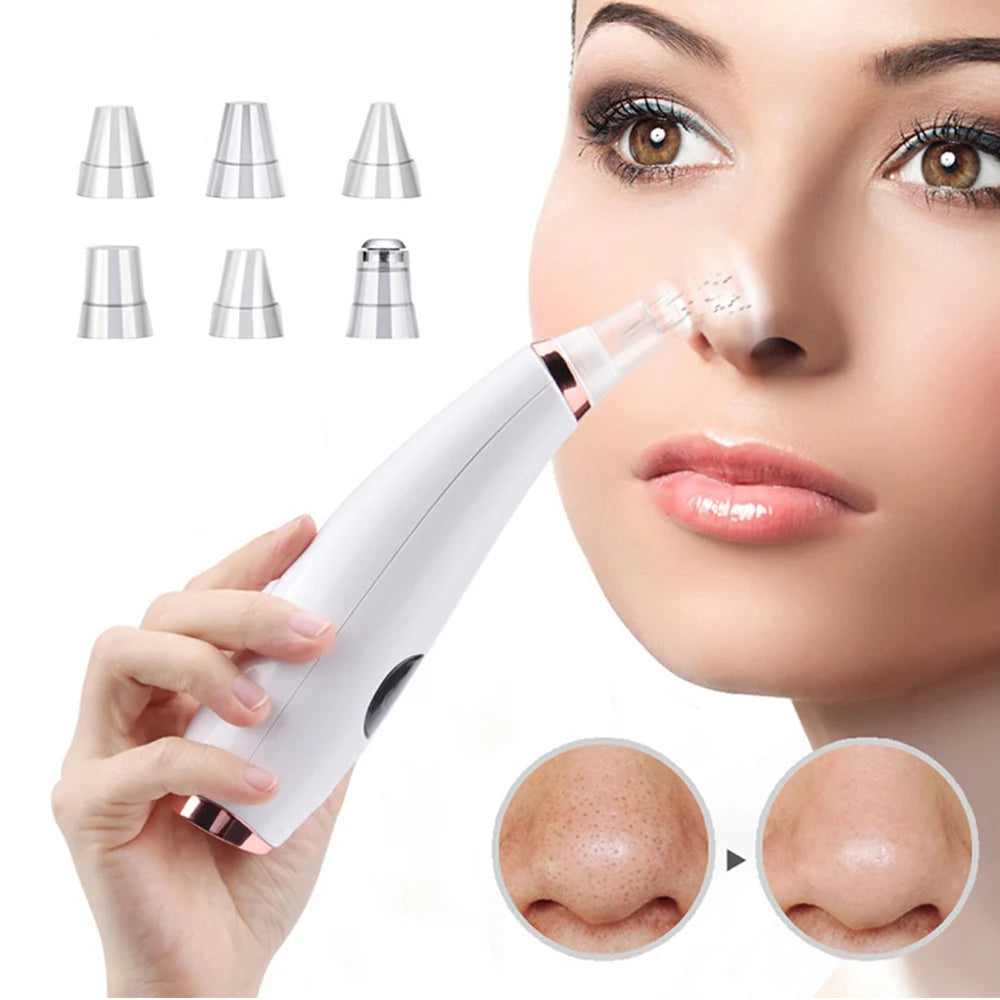 Vacuum Blackhead Remover – 7 Suction Levels | 6 Replaceable Heads | USB Rechargeable | LCD Display