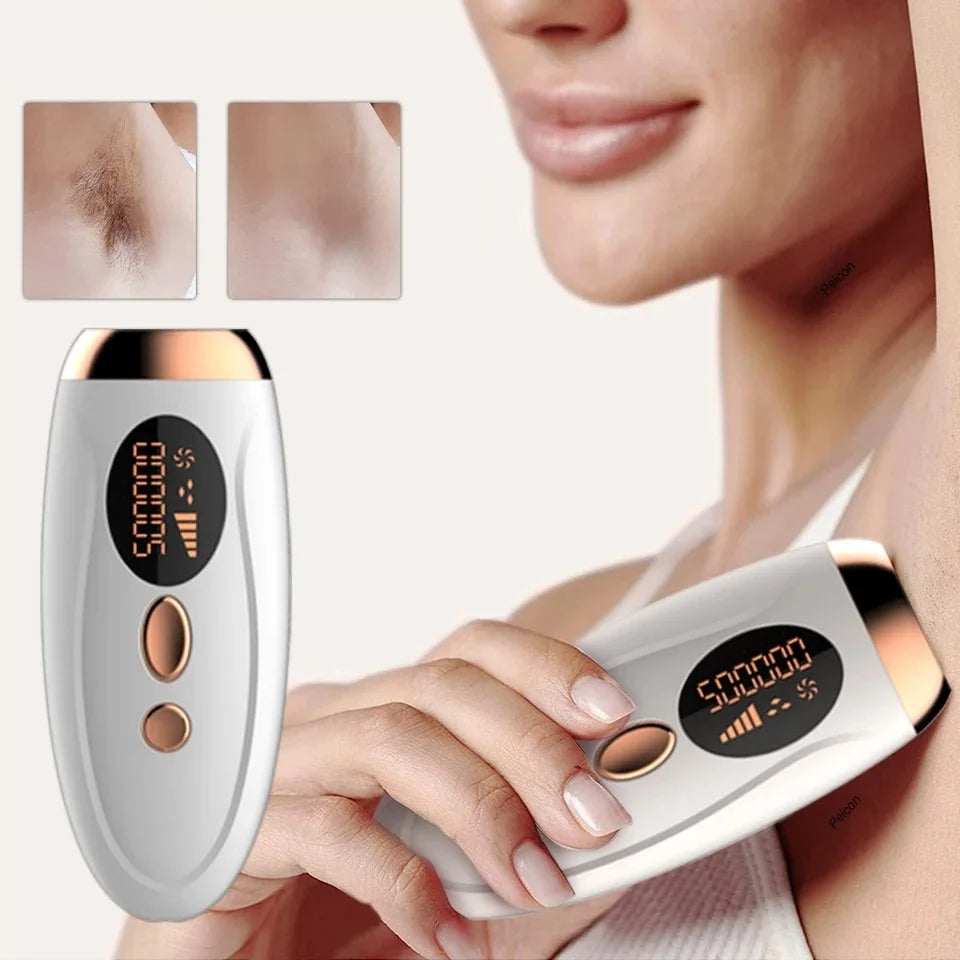 IPL Hair Removal Device – 990,000 Flashes | LCD Display | Painless Home Use | UK Plug