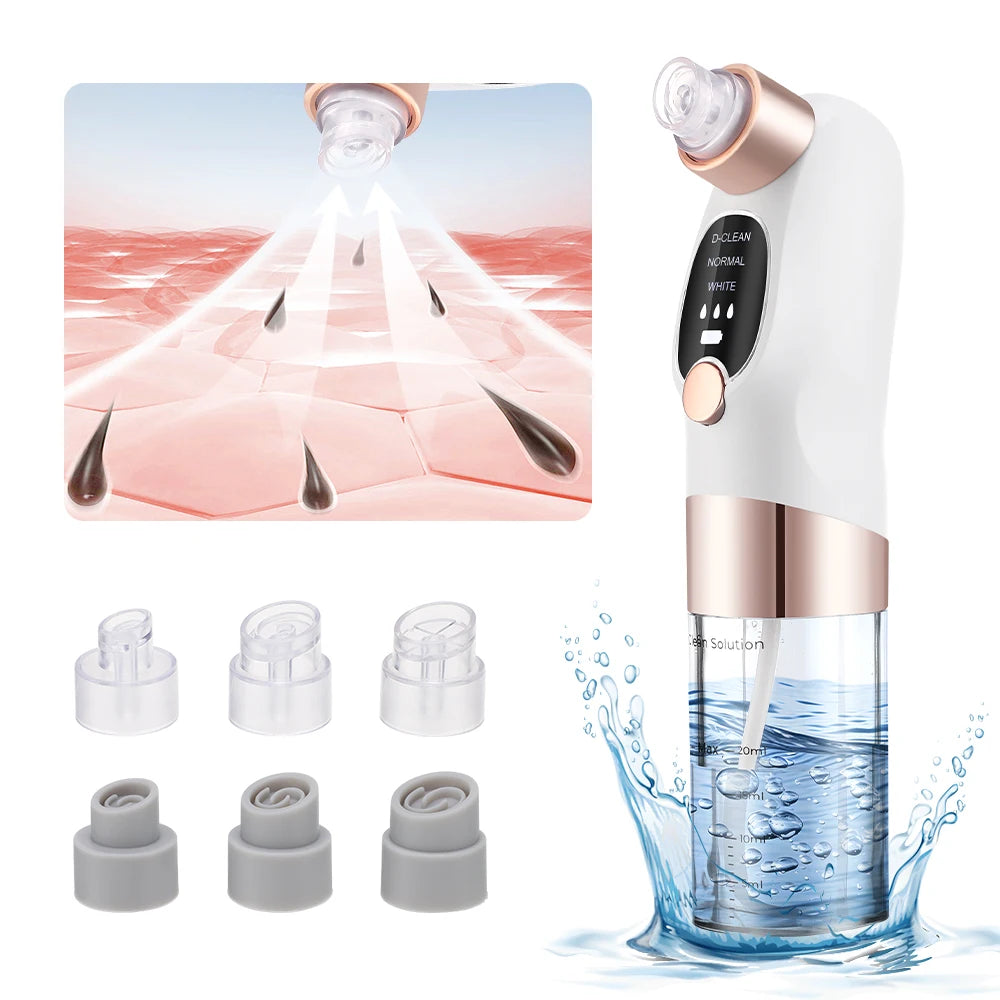 Vacuum Blackhead Remover – 3 Suction Levels | Bubble Water Infusion | USB Rechargeable