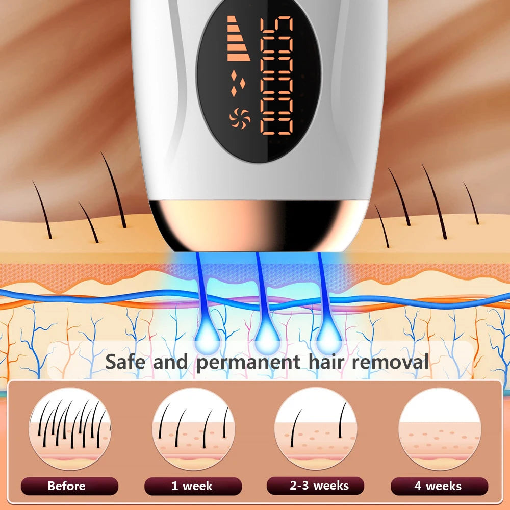 IPL Hair Removal Device – 990,000 Flashes | LCD Display | Painless Home Use | UK Plug