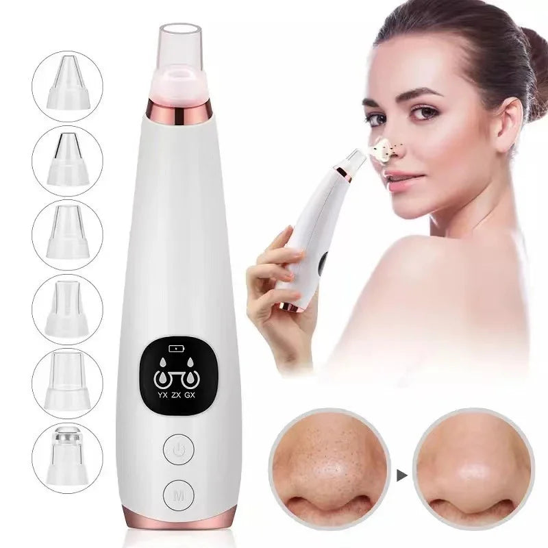 Vacuum Blackhead Remover – 7 Suction Levels | 6 Replaceable Heads | USB Rechargeable | LCD Display