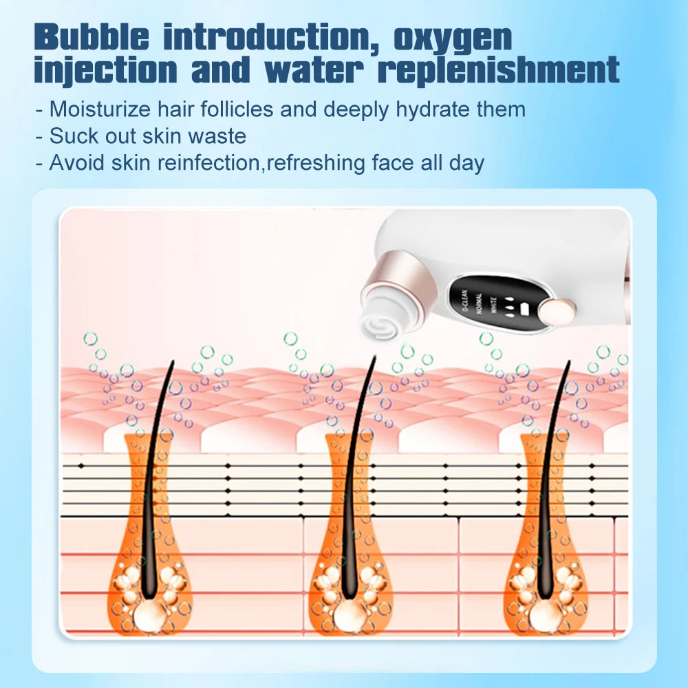 Vacuum Blackhead Remover – 3 Suction Levels | Bubble Water Infusion | USB Rechargeable