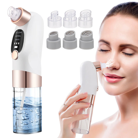 Vacuum Blackhead Remover – 3 Suction Levels | Bubble Water Infusion | USB Rechargeable